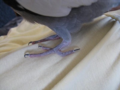 האצבע האחורית עקומה